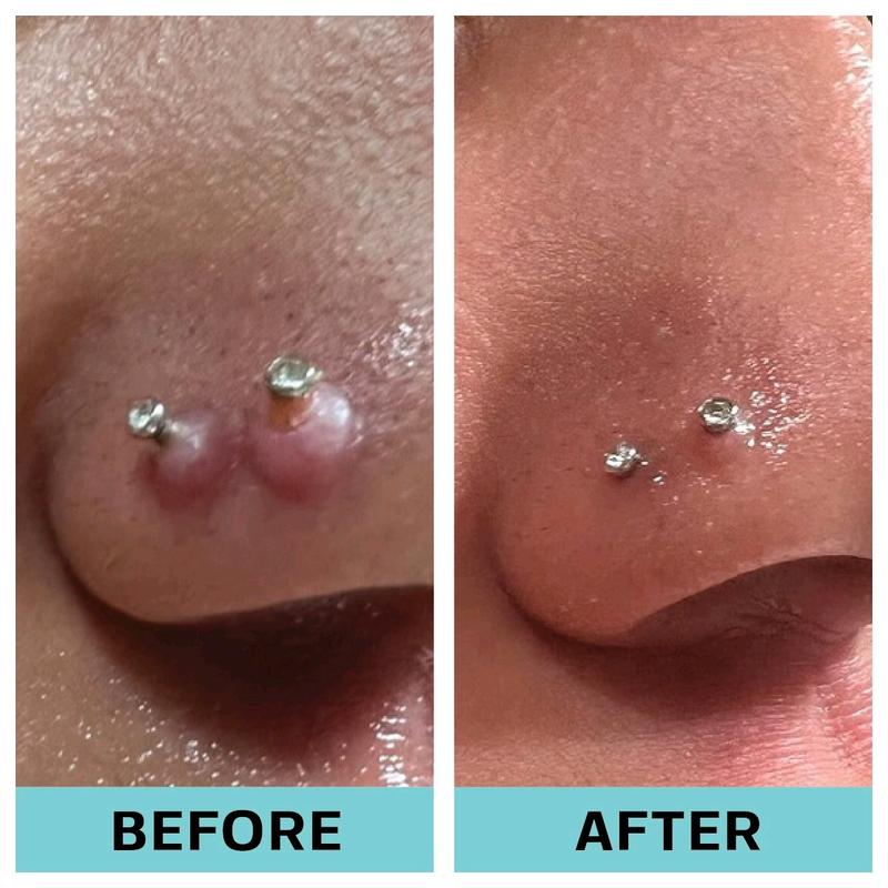 Piercing Care Serum